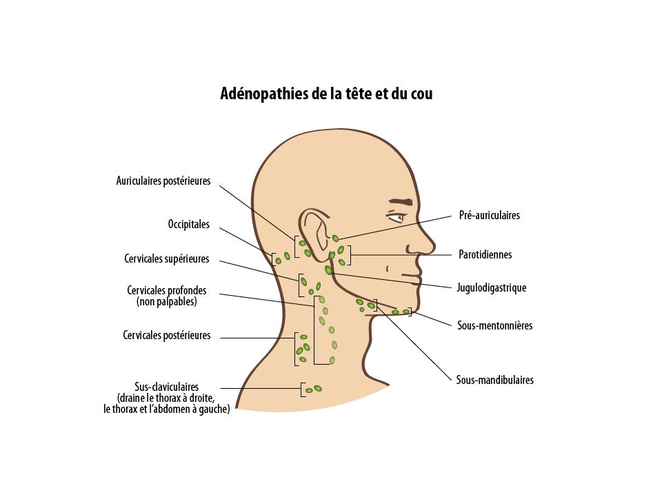 Adénopathies de la tête et du cou